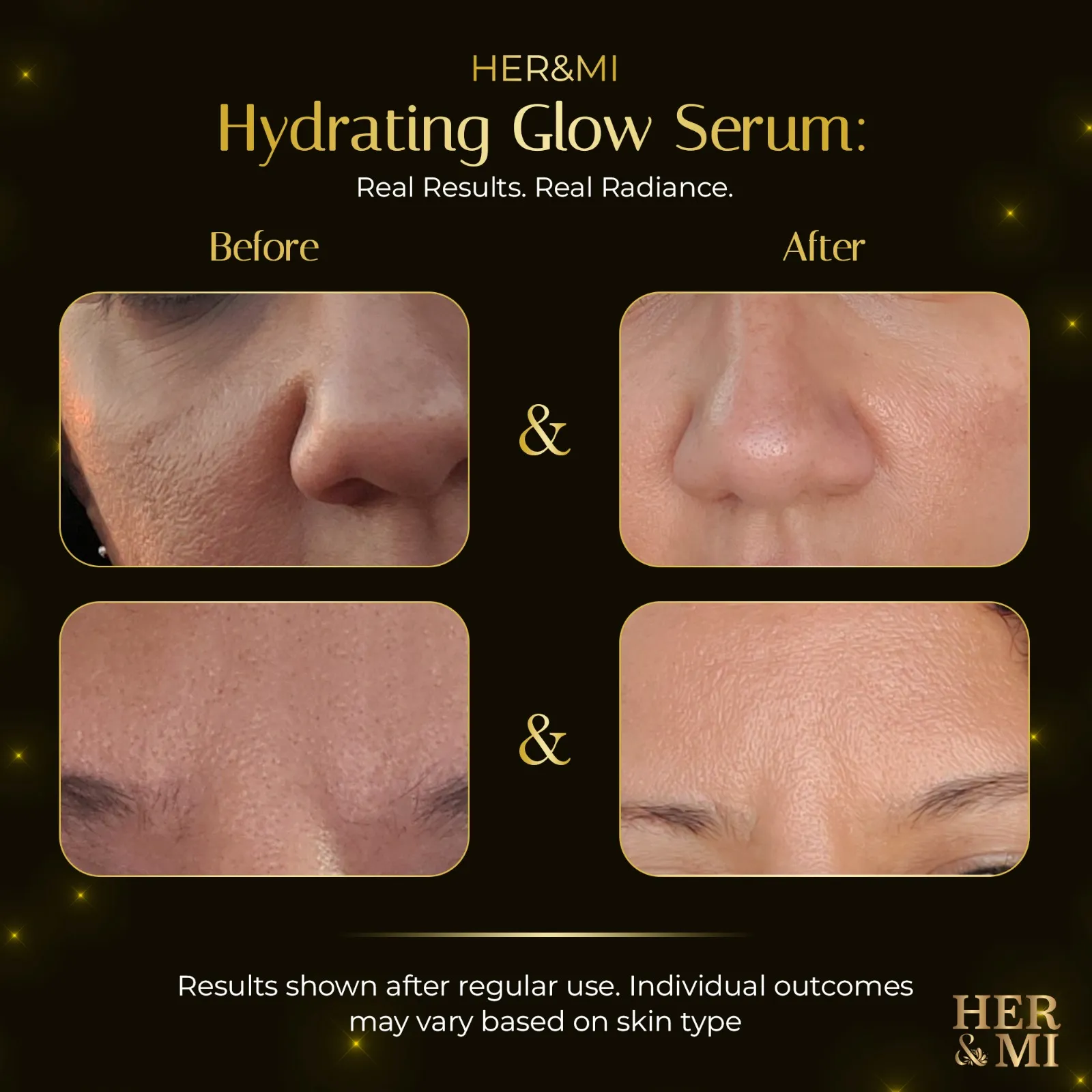 Her&Mi Hydrating Glow Serum
